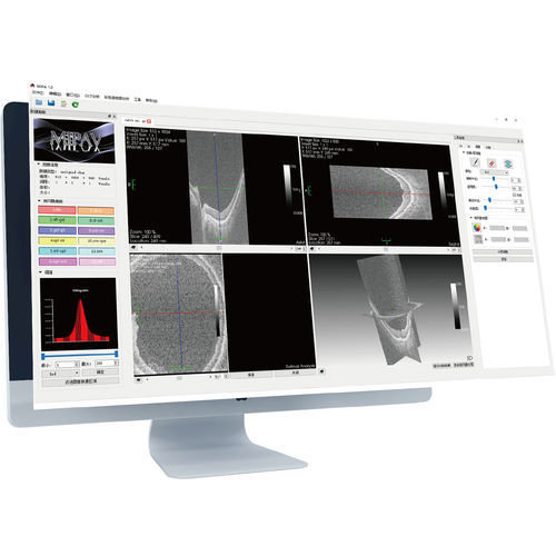 Software de asistencia - MIPA  - Big Vision Medical - para oftalmología