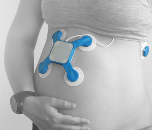 Plataforma de IA para maternidad - Baymatob - de monitorización / de diagnóstico