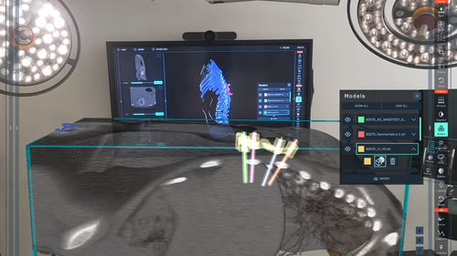 Plataforma de IA para imágenes médicas - SurgicalAR® - MEDIVIS - de planificación preoperatoria / de formación / de impresión 3D