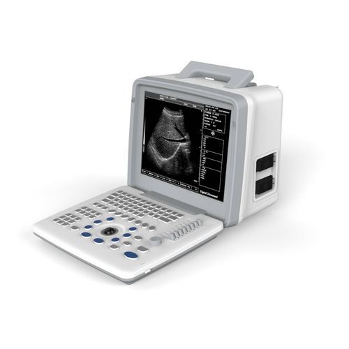Ecógrafo portátil - S300 - Somo International - para ecografía polivalente / blanco y negro / 12 pulgadas
