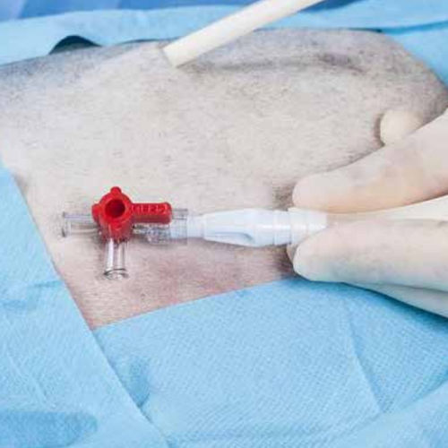 Válvula para el sector médico - 00120001 - QUIROSA, S.A - azul / roja