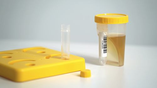 Soporte de laboratorio para tubos de ensayo - TUBYCON Inc.