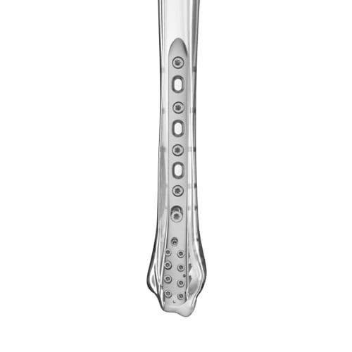 Placa de compresión para tibia - Aplus Biotechnology - porción distal / porción medial / bloqueada