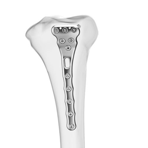 Placa de compresión para tibia - Aplus Biotechnology - porción proximal / posteromedial / bloqueada