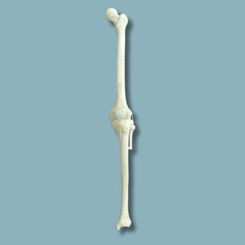 Modelo anatómico de rodilla - 04-12-02 - ADDIDREAM - de cirugía / de formación / de plástico