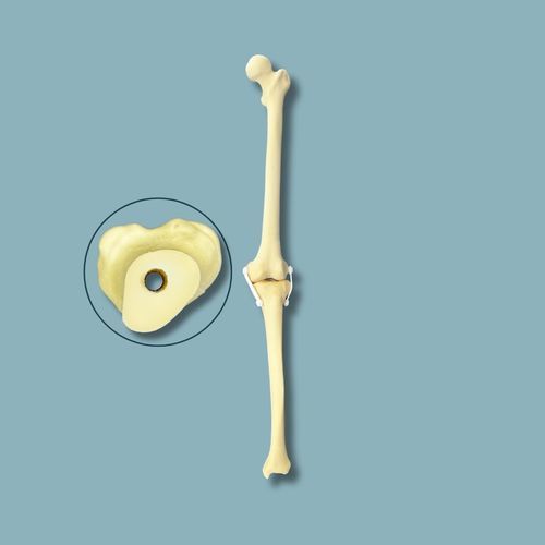 Modelo anatómico de rodilla - 04-31-02 - ADDIDREAM - de hueso / de cirugía / de formación