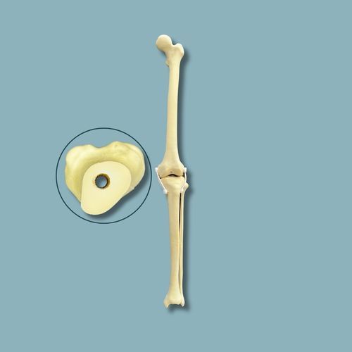 Modelo anatómico de rodilla - 04-30-03 - ADDIDREAM - de hueso / de cirugía / de formación