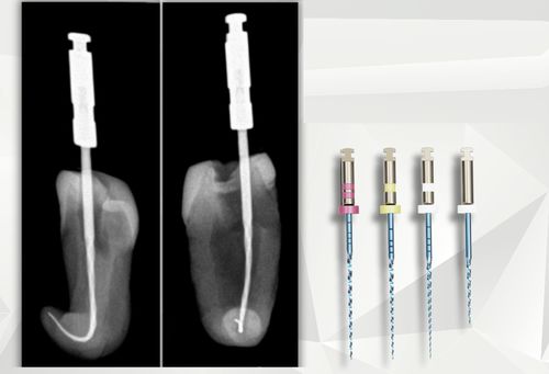 Lima dental rotativa - croot0003 - C-Root Dental Medical - para tratamiento endodóntico / NiTi