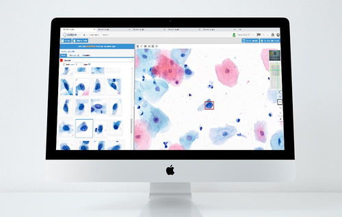 Plataforma de IA para la investigación médica - CYTOPROCESSOR® - DATEXIM - para laboratorios / para la detección del cáncer de cuello de útero / procesos basados en la web