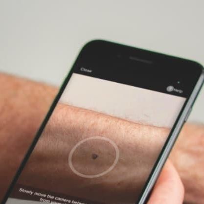 Aplicación web de diagnóstico cutáneo - SkinVision - Skinvision - dermatológica / Androïd / iOS