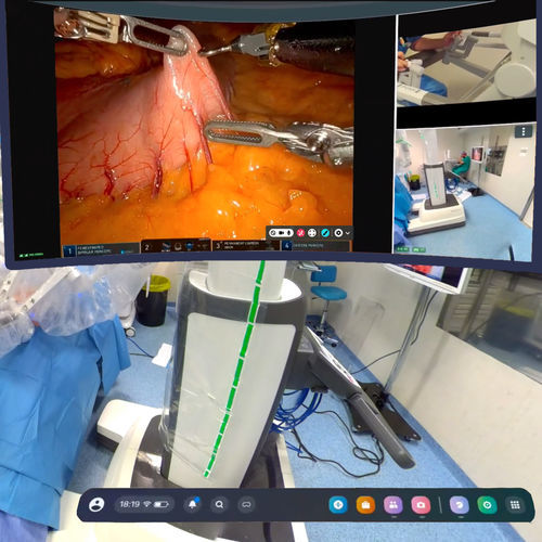 Sistema de vídeo para sala de operaciones 4K - mSurgery - mSurgery - MP4 / MPEG / AVI