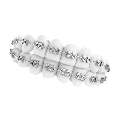 Bracket de metal - ALA-BS - Alamere Medical Corporation - estético