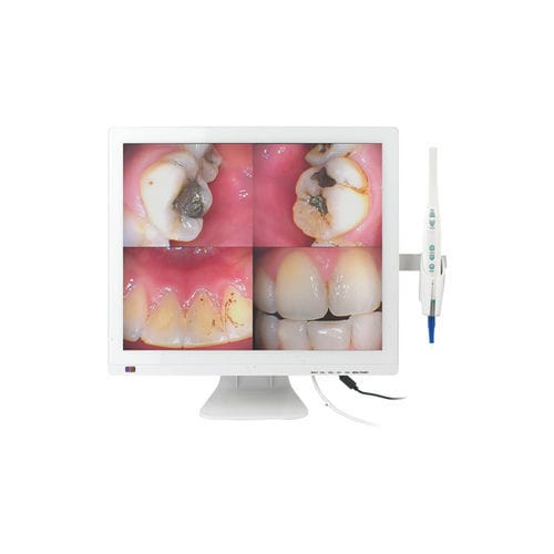Cámara intraoral - M-978V - Chuan Fu Medical Instrument Co., Ltd. - digital / CMOS