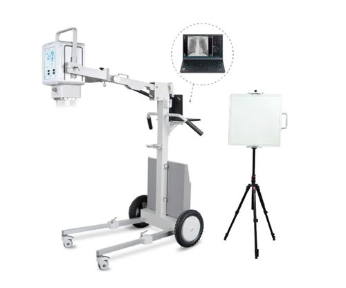 sistema de radiografía digital - YSENMED