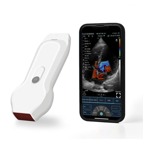 Ecógrafo de mano - YSB-C10XL - YSENMED - para ecografía cardiovascular / para ecografía de mama / para ecografía cutánea