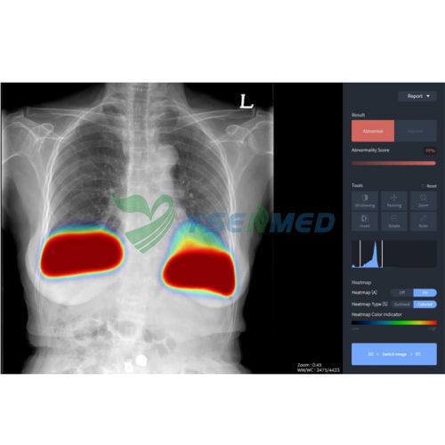 Software médico - YSX-AI-C - YSENMED - para imágenes médicas / de radiología / clínico