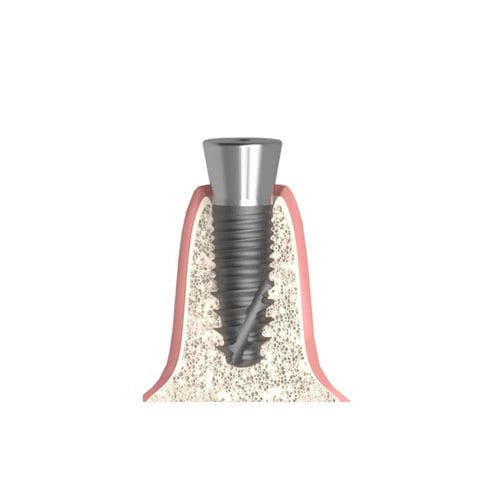 Pilar de cicatrización cilíndrico cónico - Actival - Bionika Medline Kft. - interno / de tornillo / para laboratorio dental