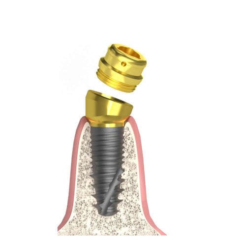 Pilar para implante cilíndrico cónico - Actival - Bionika Medline Kft. - cónico / interno / de tornillo