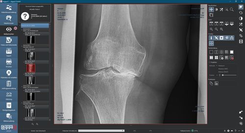 PACS para imágenes médicas - digipaX GmbH