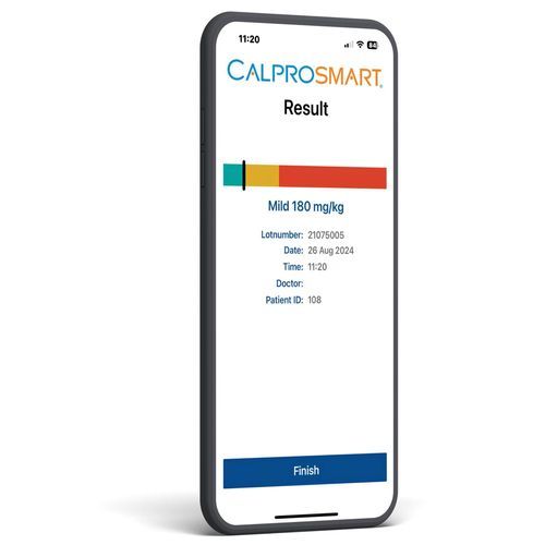Analizador POC para enfermedades inflamatorias del intestino - CalproSmart Office - Calpro AS - de inmunoanálisis / de flujo lateral / de calprotectina