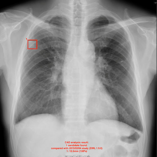 Software inteligencia artificial - EIRL - LPIXEL Inc. - clínico / de radiología / para endoscopia