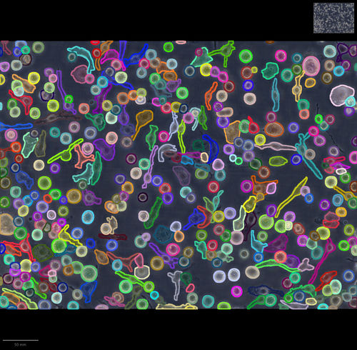Software inteligencia artificial - IMACEL - LPIXEL Inc. - de análisis de imágenes / de imágenes celulares / imagenología macroscópica de patología