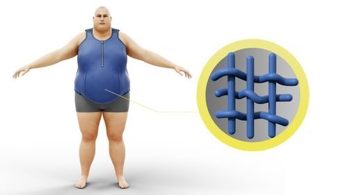 Soporte abdominal para adulto - NOVAVITA - NOVATEX MEDICAL - bariátrico / con correa / ajustable