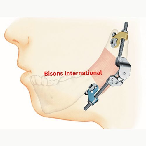 Distractor maxilar - BI-001477 - Bisons International - craneal / externo / para adulto