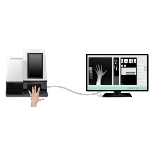 Sistema de radiografía digital - MedAlliance Inc. - para radiografía de las articulaciones / para radiografía pediátrica