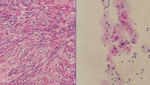Kit de reactivos hematoxilina de Harris - H-E stain - Wuhan Jinhong Biotech Development Co., Ltd. - para histopatología