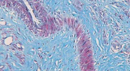 Kit de reactivos colorante - BA4079A - Wuhan Jinhong Biotech Development Co., Ltd. - para histopatología / de tejidos