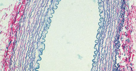 Kit de reactivos colorante - BA4083A - Wuhan Jinhong Biotech Development Co., Ltd. - para histopatología / de laboratorio / de diagnóstico