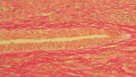 Kit de reactivos colorante - BA4084A - Wuhan Jinhong Biotech Development Co., Ltd. - para histopatología