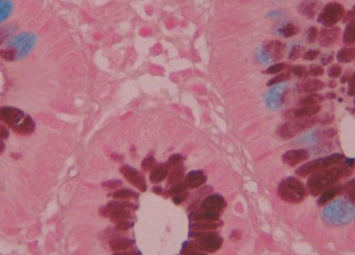 Reactivo colorante - BA4120A - Wuhan Jinhong Biotech Development Co., Ltd. - para histologia