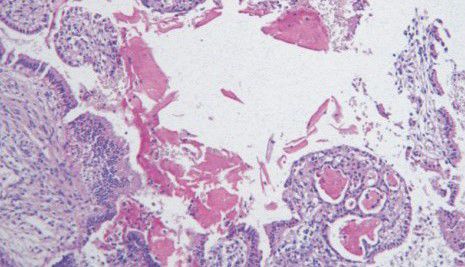 Kit de reactivos colorante - BA4086A - Wuhan Jinhong Biotech Development Co., Ltd. - para histologia / de Cryptococcus neoformans