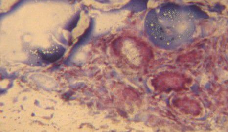 Kit de reactivos colorante - BA4088A - Wuhan Jinhong Biotech Development Co., Ltd. - para histopatología