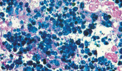 Kit de reactivos colorante - Wuhan Jinhong Biotech Development Co., Ltd. - Ácido clorhídrico / para histopatología / para la investigación