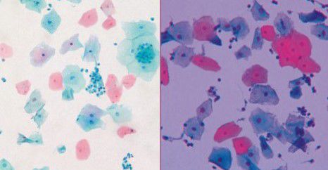 Kit de reactivos colorante - Papanicolaou Stain - Wuhan Jinhong Biotech Development Co., Ltd. - para citología / clínico