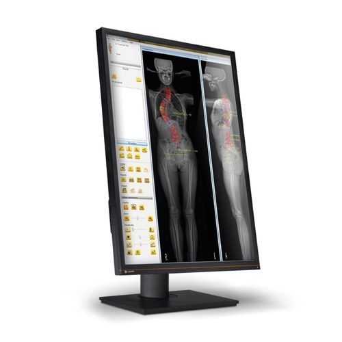 Software de modelado - EOS IMAGING - de tratamiento / de planificación / médico