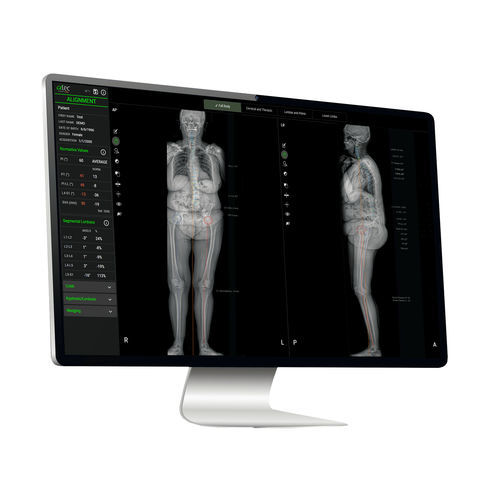 Plataforma de IA para el sector médico - EOS IMAGING - para imágenes médicas / para cuantificación / de aprendizaje automático