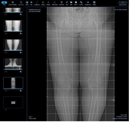 Módulo de software de medición - Orthogrid - G-Squared - de análisis de imágenes / de radiología / cuerpo