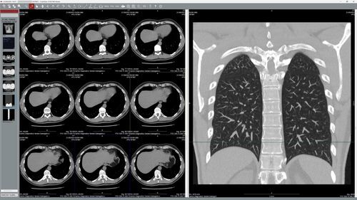 Software de visualización DICOM - EyeLite - G-Squared - médico / de teleconsulta / Windows