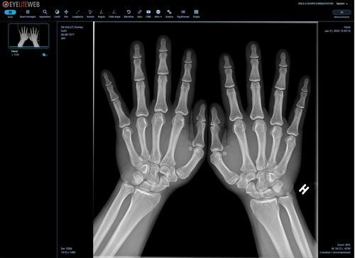 módulo de software de visualización DICOM - G-Squared