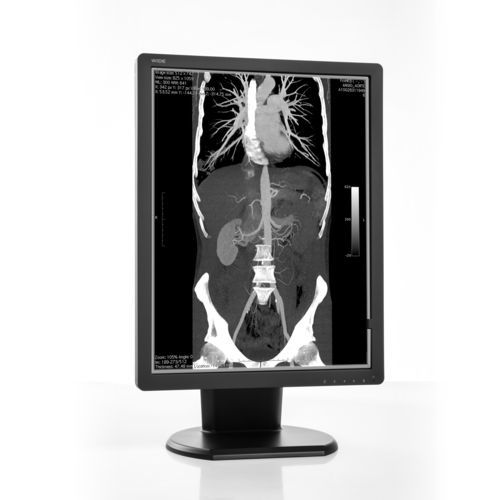 Monitor de diagnóstico - MX30N - Wide USA Corporation - para imágenes médicas / 2048 x 1536 / 21.3"