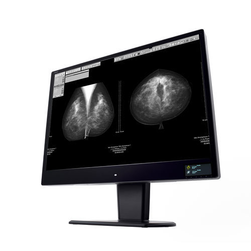 Monitor de diagnóstico - CW120N - Wide USA Corporation - para imágenes médicas / 31" / LCD
