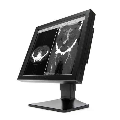 Monitor de diagnóstico - MX10P - Wide USA Corporation - para imágenes médicas / 1280 x 1024 / 19"