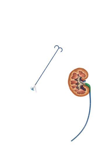 Vaina de acceso ureteral - FY series - Hunan Endovascular Device Co., Ltd. - renal / orientable / atraumática