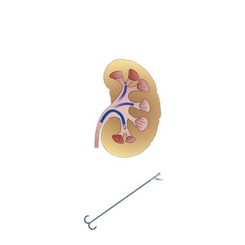 Vaina de acceso ureteral - FY series - Hunan Endovascular Device Co., Ltd. - renal / orientable / atraumática