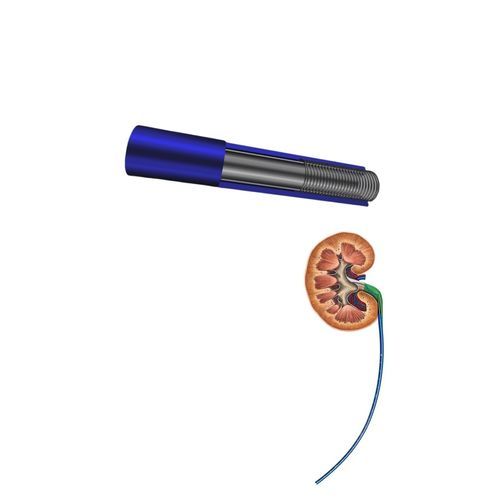 Vaina de acceso ureteral - FY series - Hunan Endovascular Device Co., Ltd. - renal / atraumática