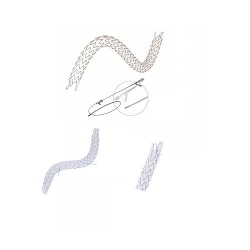 Stent ureteral - EUS0919514 - Hunan Endovascular Device Co., Ltd. - de nitinol / con recubrimiento